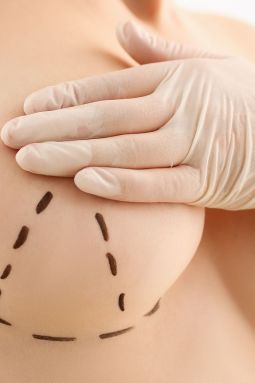 Cirugía de elevación de mamas en Tijuana